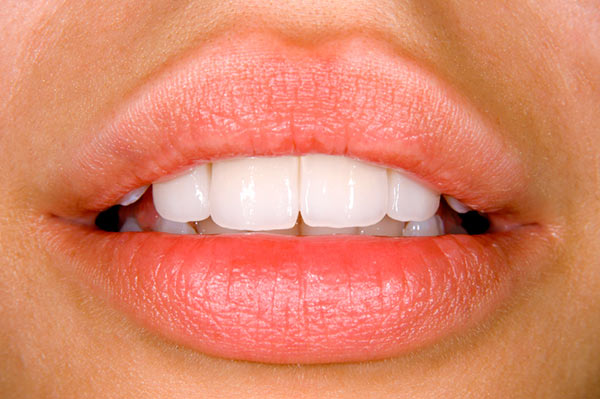 A close up of teeth after dental bonding