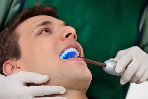 A dentist using a curing light to apply a dental sealant on a male patient's teeth at San Francisco Dental Arts in San Francisco, CA