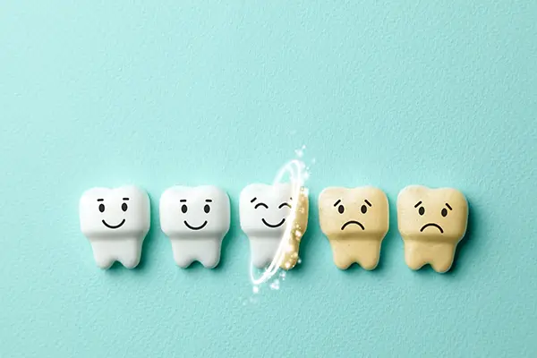 A row of toy teeth passing through teeth whitening that changes them from sad and yellowed to white and happy at San Francisco Dental Arts in San Francisco, CA