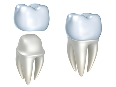 What Are the aims of Porcelain Crowns?