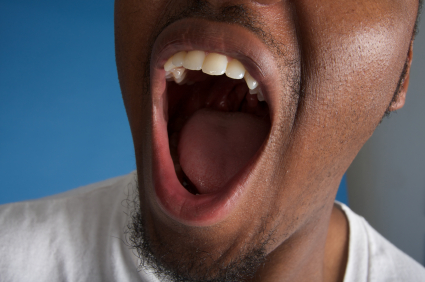 Signs of a Dry Mouth and How to Treat It