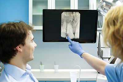 How Often Should You Have Dental X-Rays Taken?